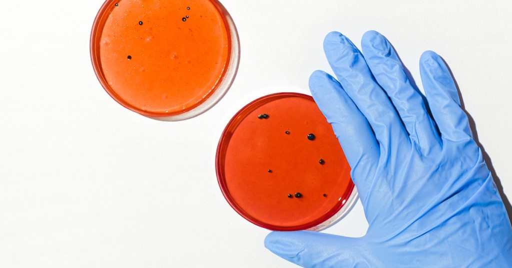 hand moving petrie dish which contain agarose and bacteria